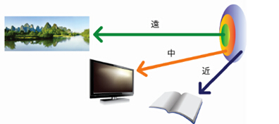 不,要等,白内障,成熟,时,才,做,手术,白内障, 不,要等,白内障,成熟,时,才,做,手术,白内障,