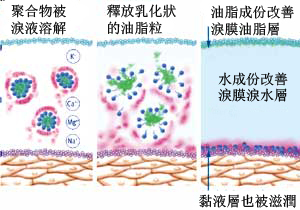 干眼,难忍,、,视,力差,十分钟,激光治疗, 干眼,难忍,、,视,力差,十分钟,激光治疗,
