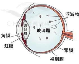 治疗,飞蚊,症选,希玛,体验,正规,医院,飞蚊,症, 治疗,飞蚊,症选,希玛,体验,正规,医院,飞蚊,症,