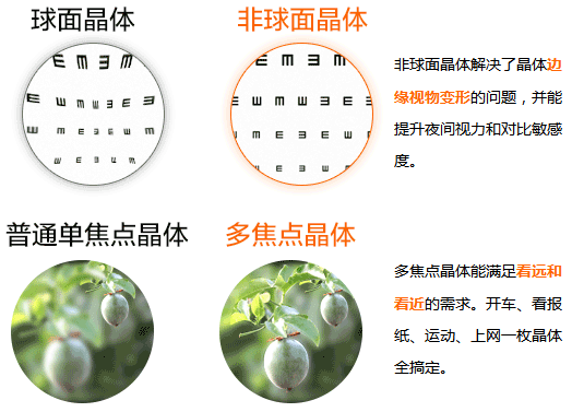 希玛,医生,重点,讲解,引起,白内障,的, 希玛,医生,重点,讲解,引起,白内障,的,